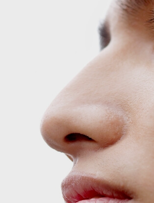 鼻の整形のイメージ図