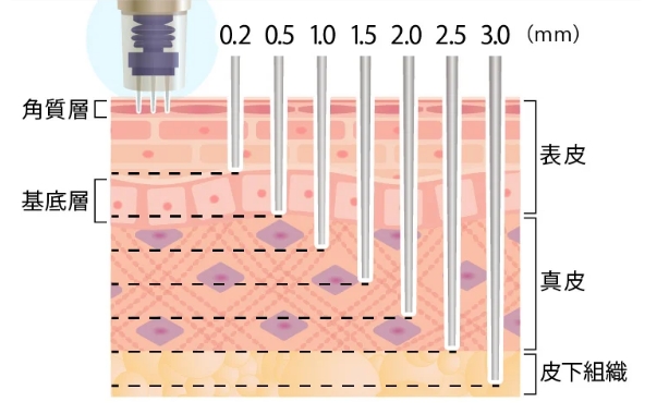 痛み・腫れが少ない