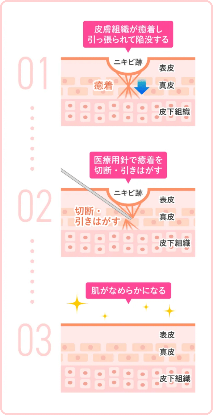 効果とメカニズム