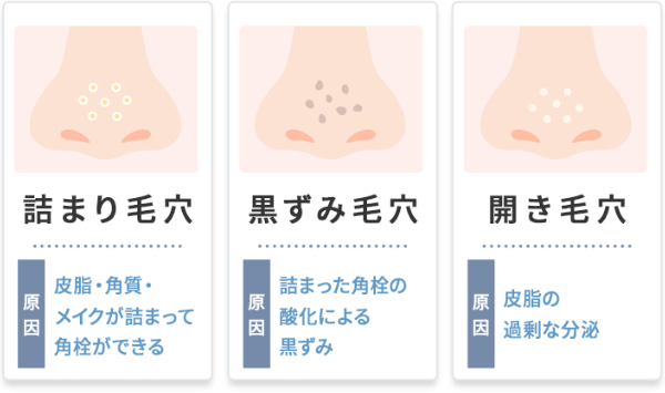 毛穴悩みのケアにおすすめ