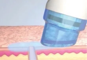 クレンジング＋ピーリング