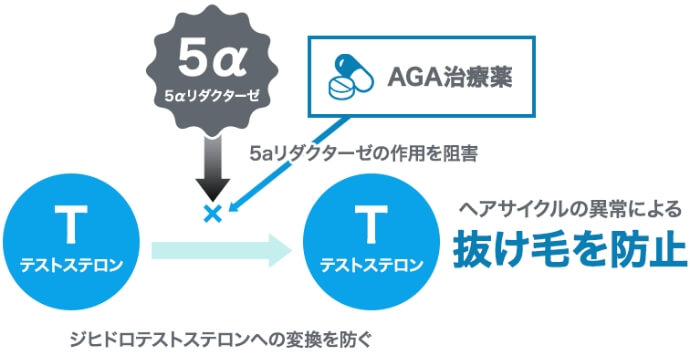 5αリダクターゼの作用を阻害