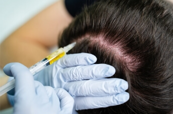 AGAメソセラピー