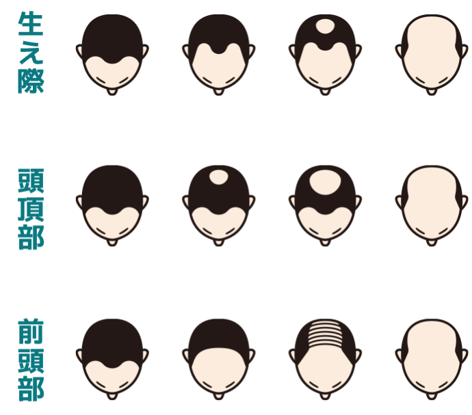 進行のイメージ