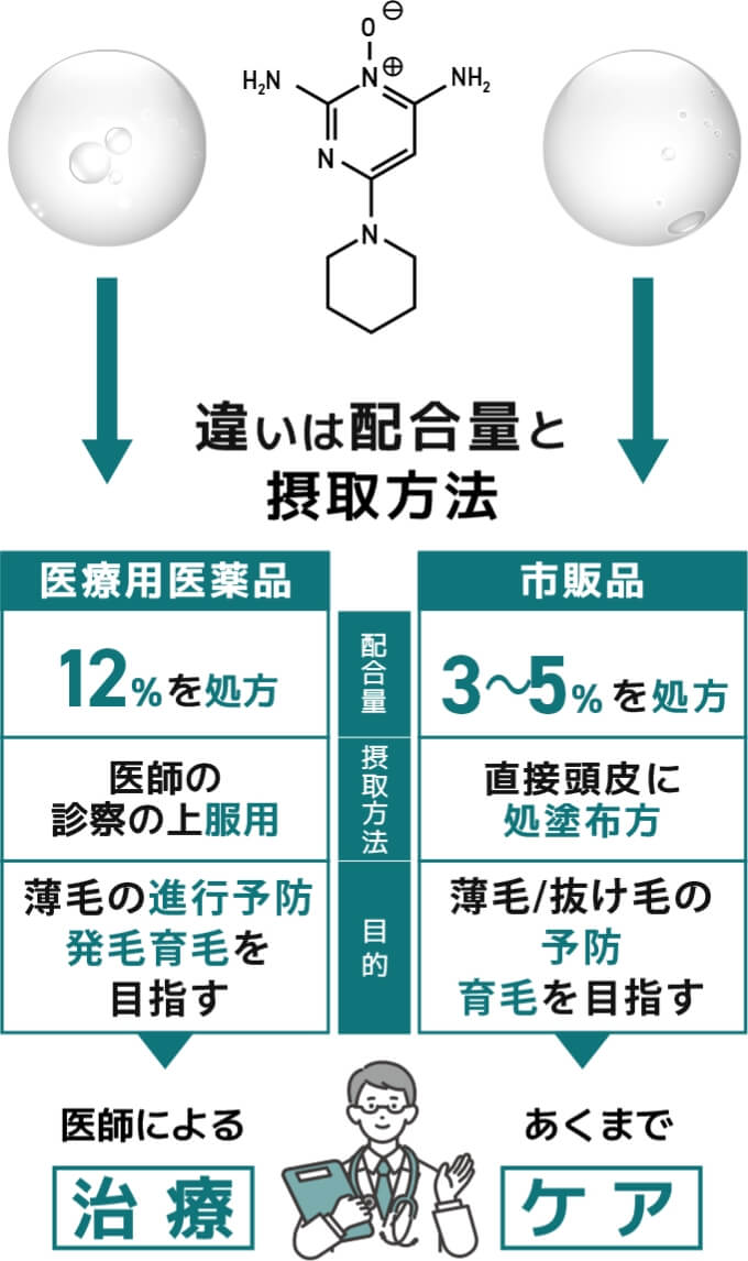 AGAは進行性の病気です。