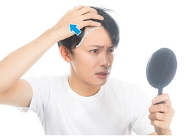 額が広くなった