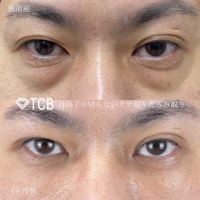 症例写真