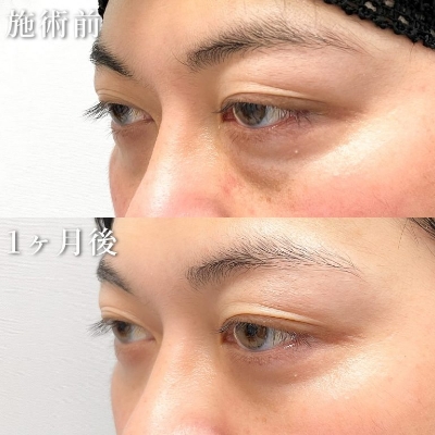 症例写真