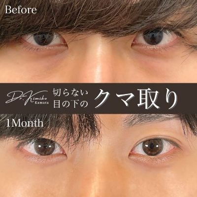症例写真