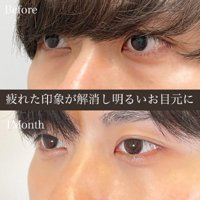 症例写真