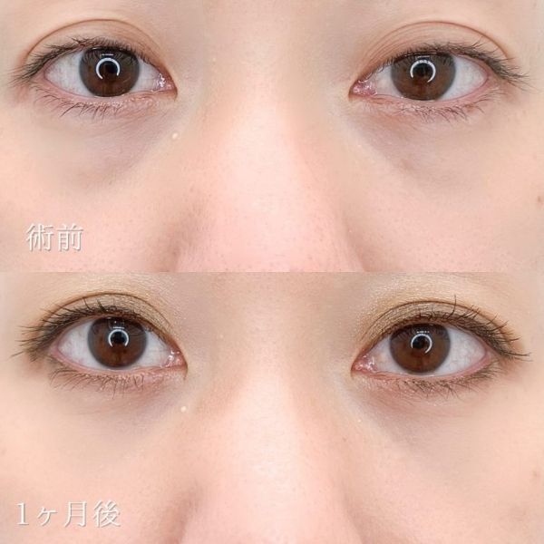 症例写真