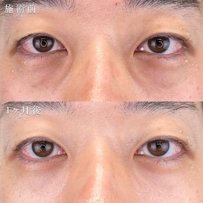 症例写真