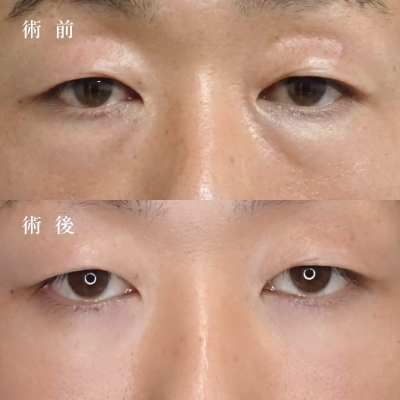 症例写真