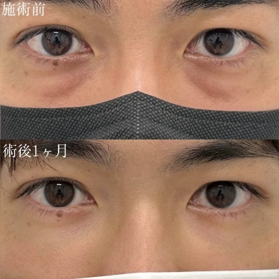 症例写真