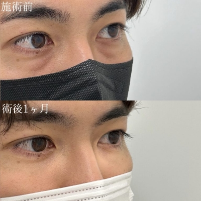 症例写真