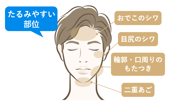 医療ハイフの適応部位