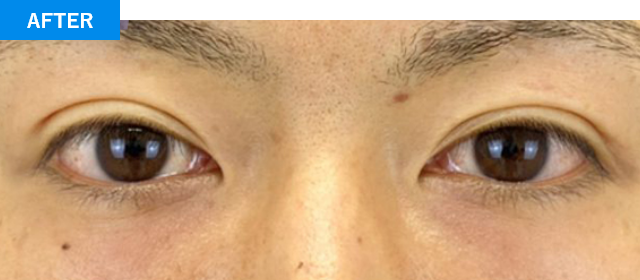 AFTER