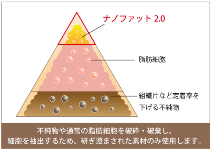 不純物や通常の脂肪細胞を破砕・破棄し、細胞を抽出するため、研ぎ澄まされた素材のみ使用します。