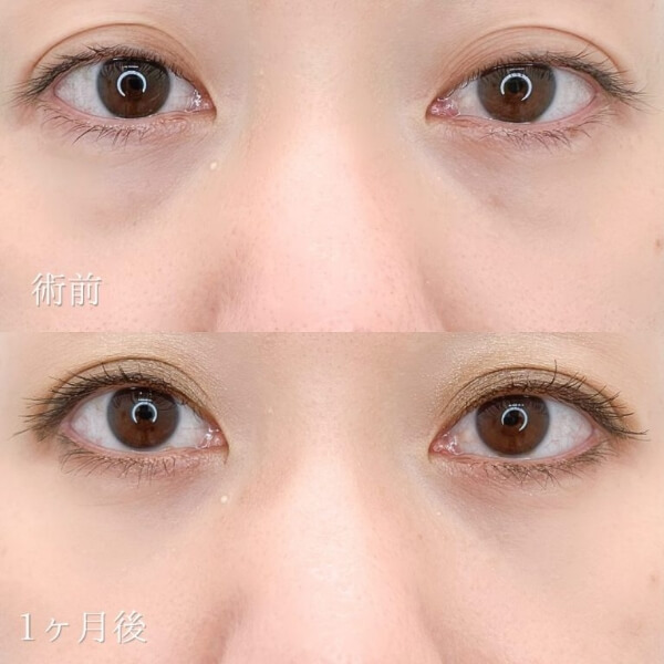 症例写真