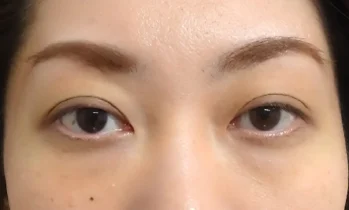 茶クマ before
