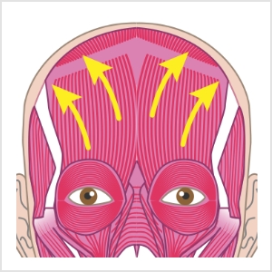 シワ改善ボトックス注射とは？