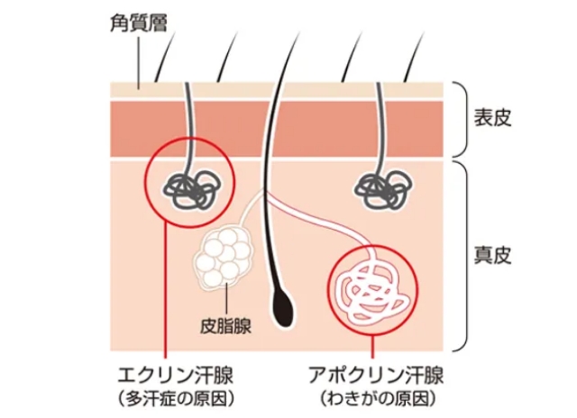 多汗症ボトックス注射とは？