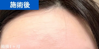 施術後