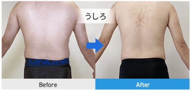 before after うしろ