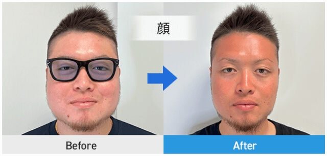 before after 顔