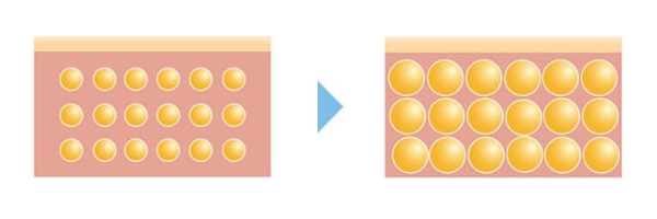 太りやすさにつながる「脂肪細胞」にアプローチ