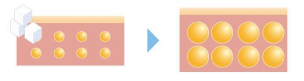 食欲を自然に抑える医療サポート