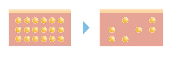 太りやすさにつながる「脂肪細胞」にアプローチ