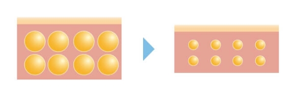 運動が難しい方にも筋肉への医療的アプローチ