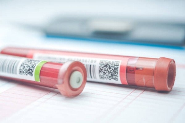 血液検査・遺伝子検査