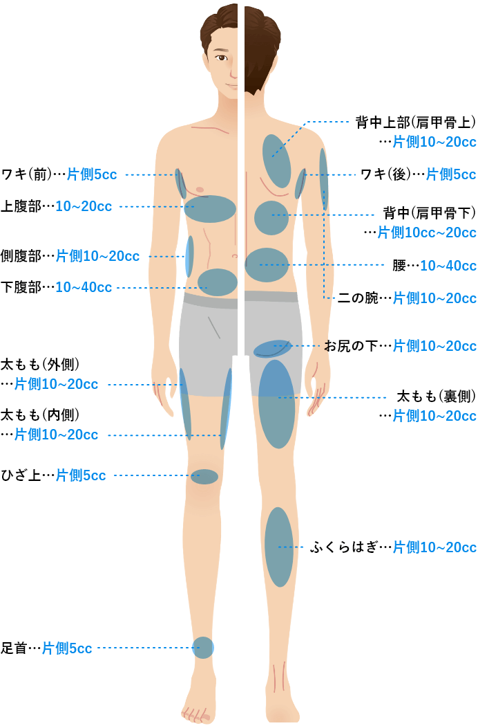 BNLSルティメット（脂肪溶解注射）の施術部位一覧