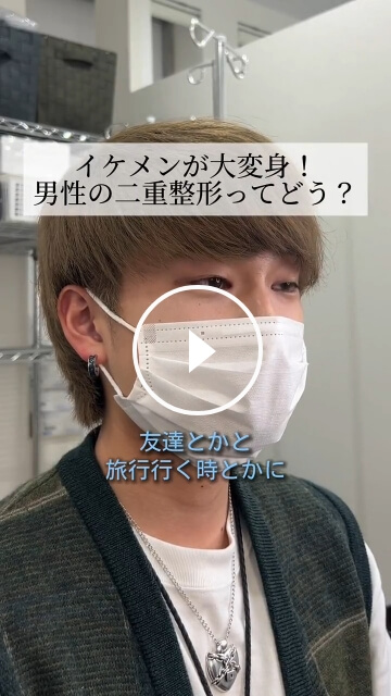理想の二重を叶えるTCB二重術