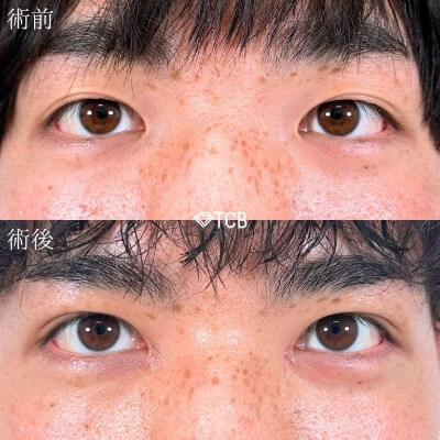 症例写真