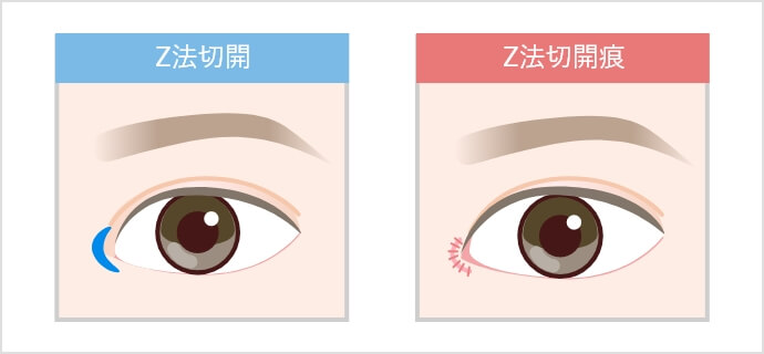 三日月法