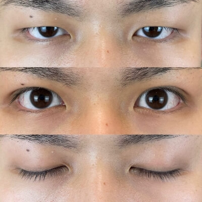 症例写真