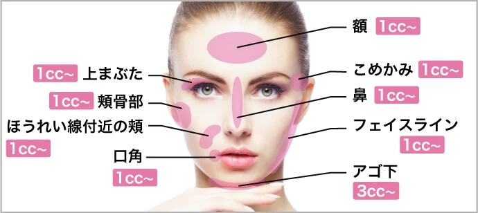 脂肪溶解注射部位