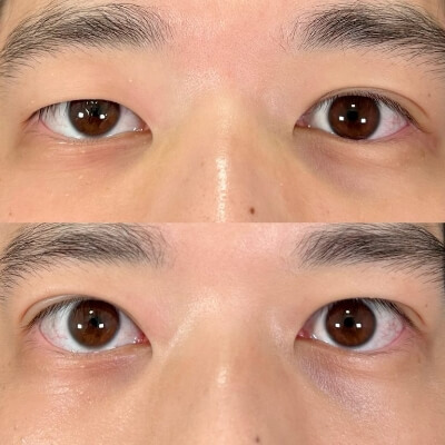 症例写真