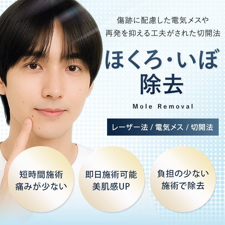 ほくろ・いぼ除去