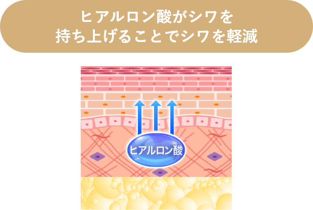 ヒアルロン酸がシワを持ち上げることでシワを改善