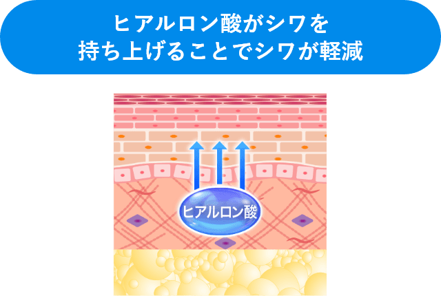 ヒアルロン酸がシワを持ち上げることでシワが軽減