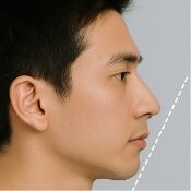 輪郭をシャープに