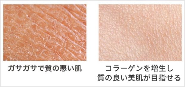 ガサガサで質の悪い肌からコラーゲンを増生し質の良い美肌が目指せる