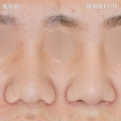 症例写真