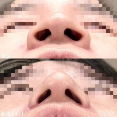 症例写真