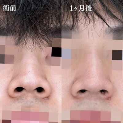 症例写真