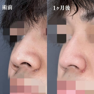 症例写真